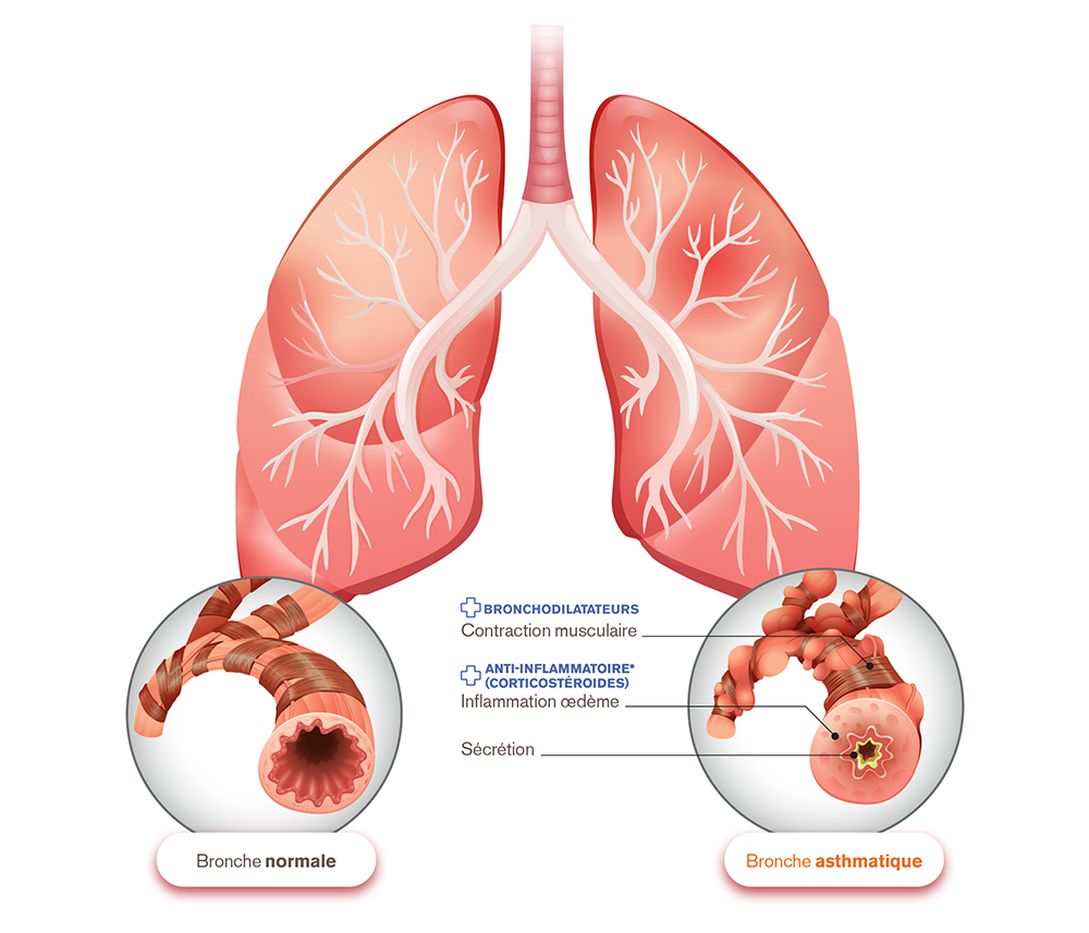 lungs